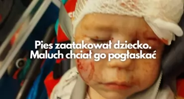 Pogryzienie trzyletniego dziecka w twarz. Pomocy udzielił kierowca autobusu